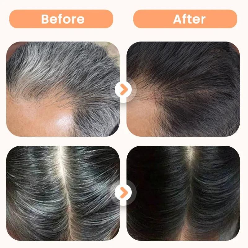 Herbal Hair Dye for Gray Hair – 200ml | Plant-Based, No Ammonia, with Fo-Ti, Black Sesame & Biota | For Women